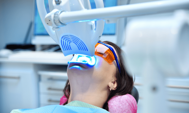 While over-the-counter whitening products promise dramatic results, they often fall short when compared to professional teeth whitening.