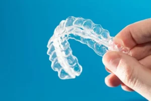 Why Professionals Are Choosing Clear Aligners in Elgin, IL